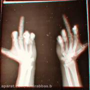 میمیرم اگه بازم بخواد بیاد نگات نگات کنه..!💔👁️