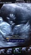 حاجی پشمام چقد با نمکه این۰😂..‌‌‌