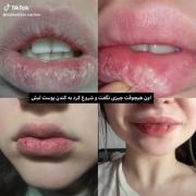 نشانه‌های خاموش استرس و درد روحی