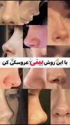 با این ماساژ دماغ رو بینی کن .