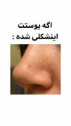 اگه پوستت این شکلیه این معجزه است